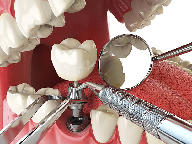 Best Emergency Treatment for Toothache in Cambridge, MA